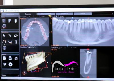 radiografia 3d resultados clinica dental arjona los villares