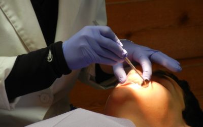 Señales para detectar gingivitis en los más pequeños