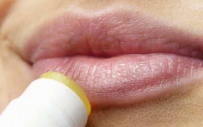 ¿Qué es el herpes labial ?