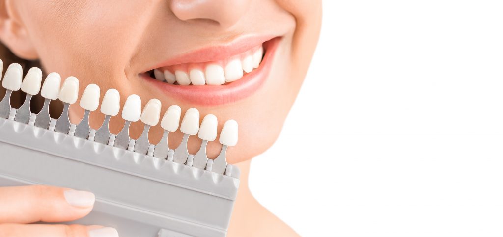 Escala de color de dientes: ¿Cuántos tipos de blancos existen?