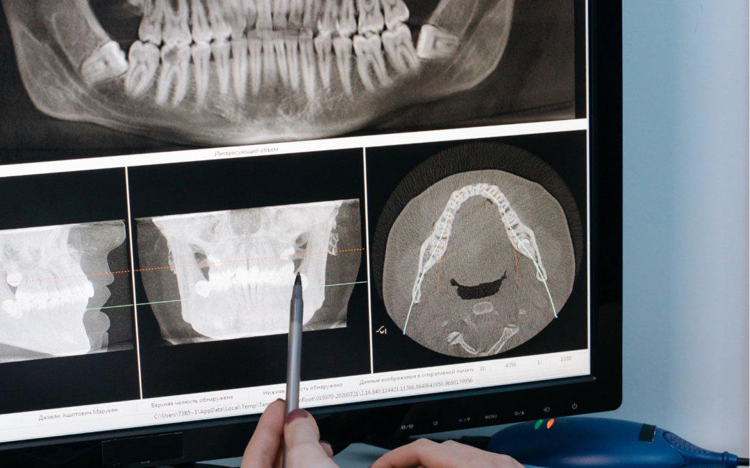 Historia de la odontología en España y en el mundo