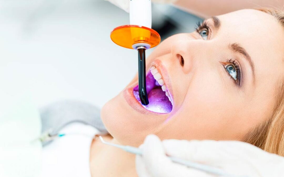 Conoce las diferentes técnicas de blanqueamiento dental