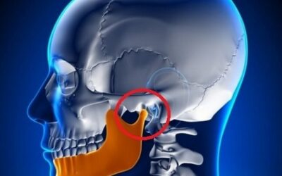 Consejos para el cuidado de la articulación temporomandibular